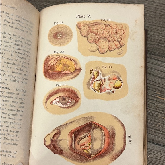 Antiquarian Medical Books 1800’s The Peoples Medical Advisor physiology hygiene - Picture 9 of 16